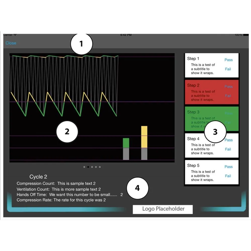 CPARLENE® Full-Size Manikin with CPR Metrix and iPad®* - Dark